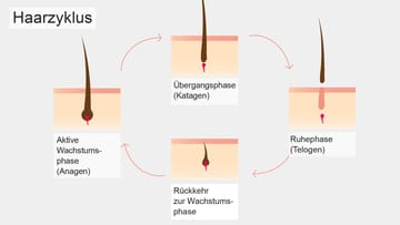 Diffuser Haarausfall Ursachen Symptome Und Behandlung