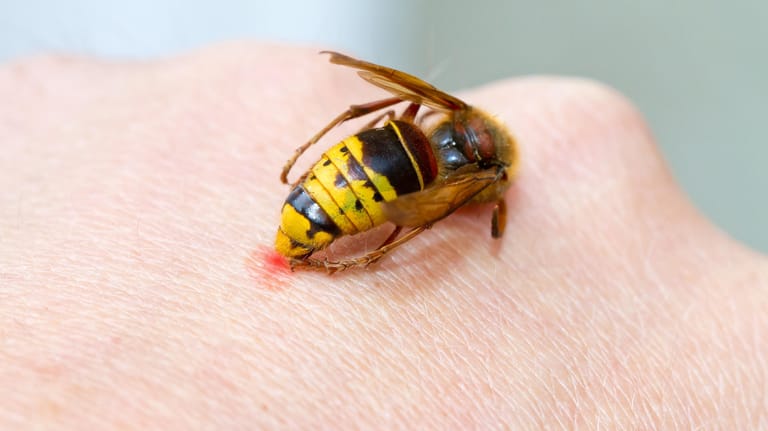 Ein Stich der Wespe oder Biene kann eine anaphylaktische Reaktion hervorrufen