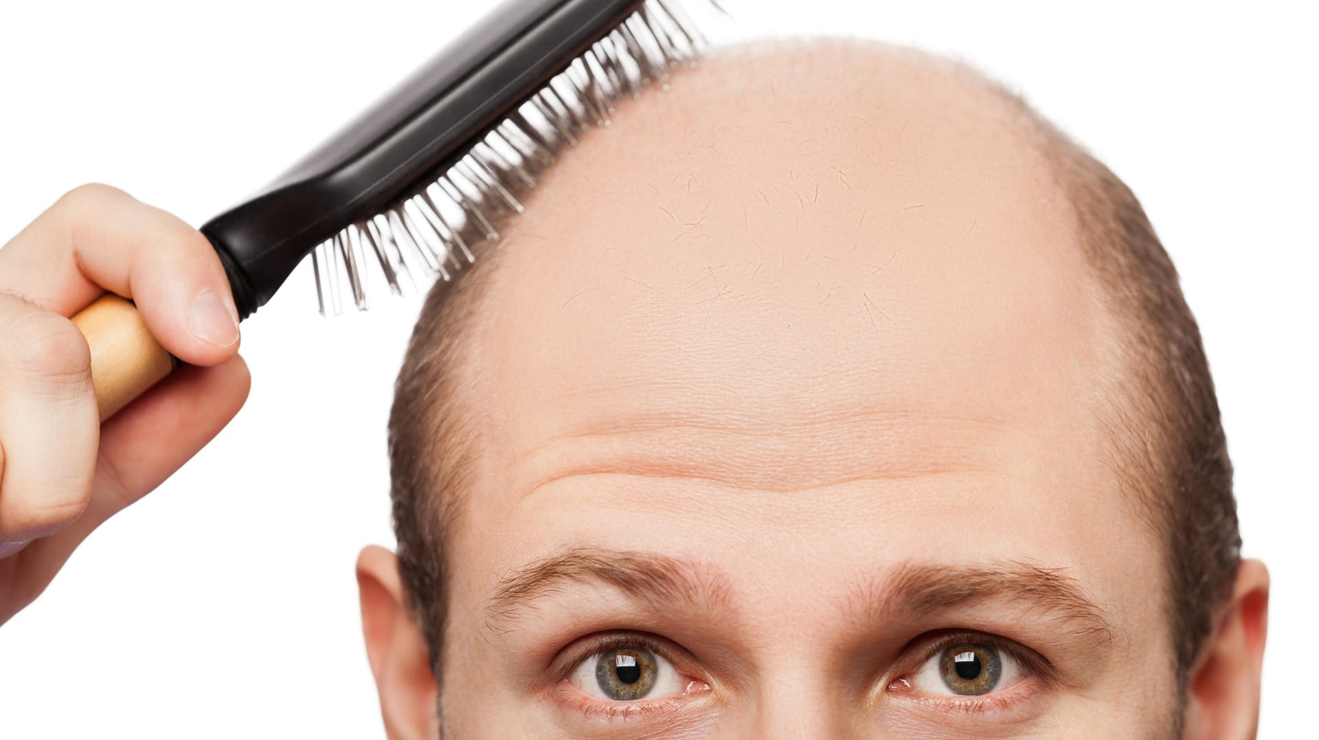 Ein Mann mit Glatze fährt sich mit einer Haarbürste über den Kopf. Ein Mann mit Glatze fährt sich mit einer Haarbürste über den Kopf.