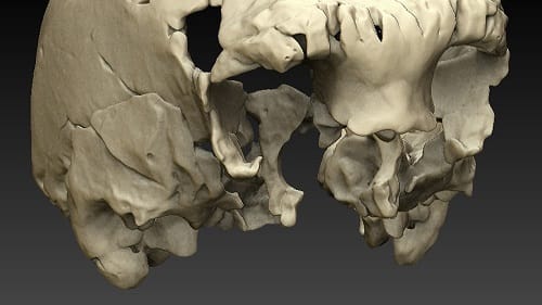 Wissenschaftler haben einen 400.000 Jahre alten Menschenschädel virtuell rekonstruiert. Wissenschaftler haben einen 400.000 Jahre alten Menschenschädel virtuell rekonstruiert.