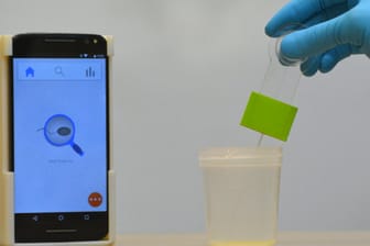 Das Fruchtbarkeits-Testsystem besteht aus einem optischen Zubehörteil, auf dem das Smartphone befestigt wird (l) und einer Spermaprobe (r).
