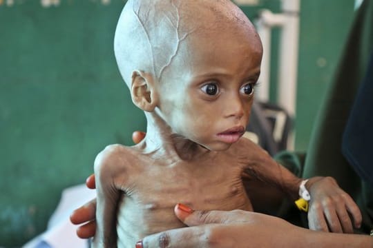 20 Millionen Menschen in vier Ländern sind vom Hungertod bedroht.