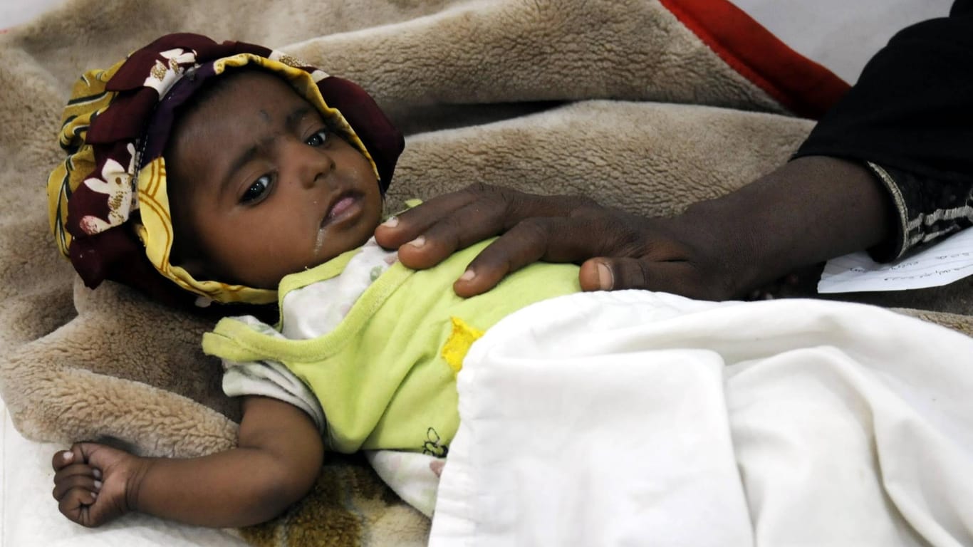 Sanaa (Yemen): Eine Mutter legt ihre Hand auf ihr unterernährtes Kind
