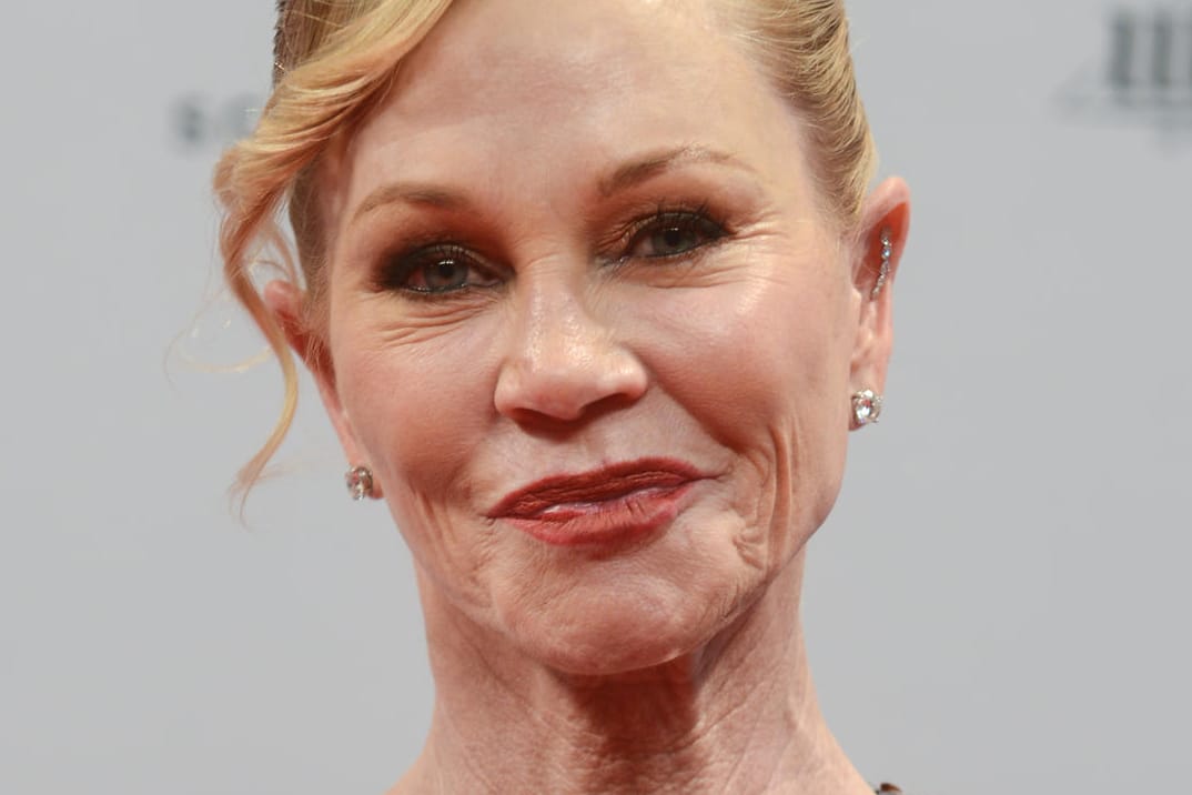 Melanie Griffith sieht nach zahlreichen Eingriffen sehr verstellt aus