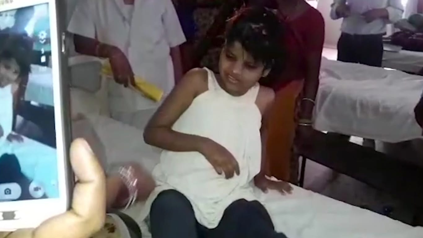 Das indische Mädchen, das mit Affen zusammenlebte, befindet sich aktuell in einem Krankenhaus.