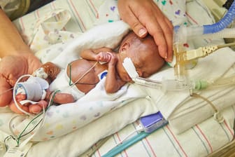 Ein zu früh geborenes Baby im Children's Hospital of Philadelphia in Philadelphia, USA .
