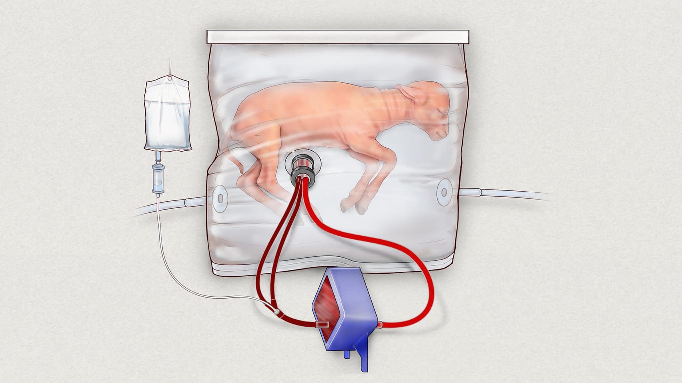 Die Illustration vom Children's Hospital of Philadelphia zeigt ein Lamm in einem Beutel, einer Art künstlicher Gebärmutter.