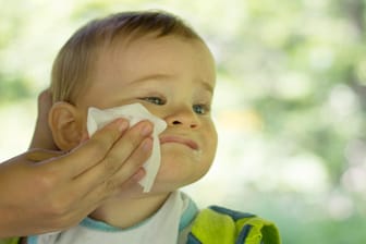 Die belasteten Baby-Feuchttücher können bei sensiblen Personen allergische Kontaktdermatitis auslösen.