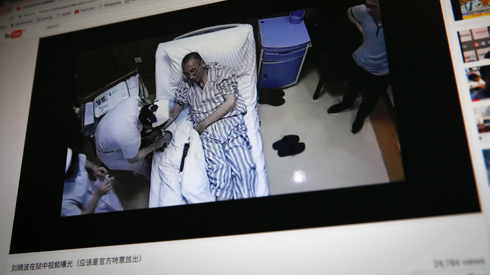 Das Foto vom 29. Juni 2017 zeigt Liu Xiaobo. Laut Bericht des Krankenhauses wird der Menschenrechtler künstlich ernährt. Das Foto vom 29. Juni 2017 zeigt Liu Xiaobo. Laut Bericht des Krankenhauses wird der Menschenrechtler künstlich ernährt.
