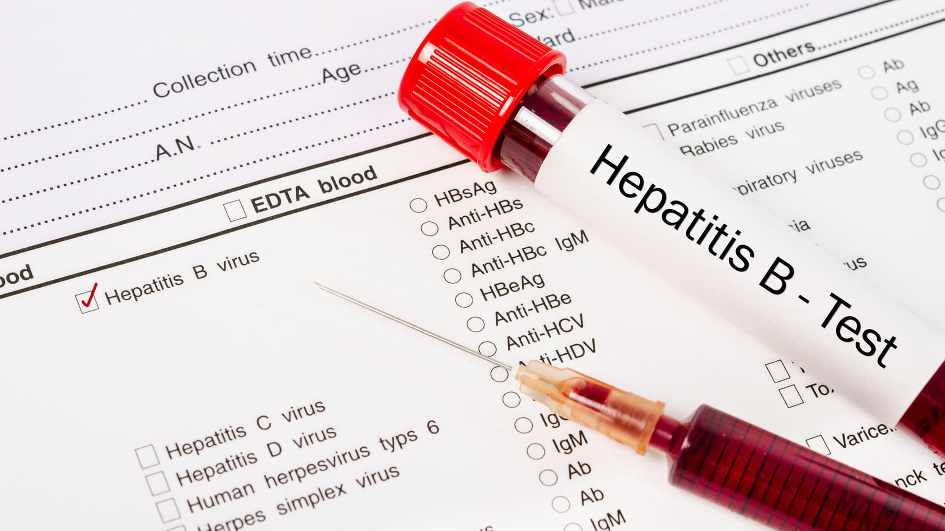 Hepatitis B Test