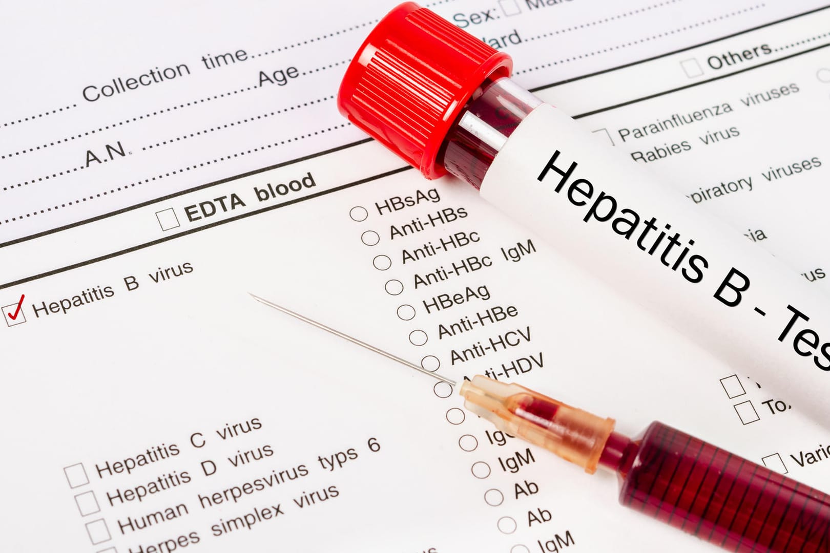 Hepatitis B Test