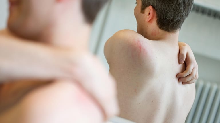 Juckreiz, trockene und schuppende Haut – was Sie gegen Hautkrankheiten unternehmen können.