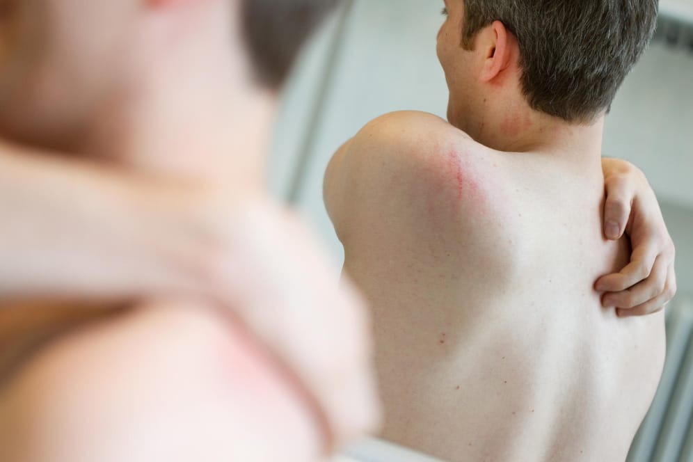 Juckreiz, trockene und schuppende Haut – was Sie gegen Hautkrankheiten unternehmen können.