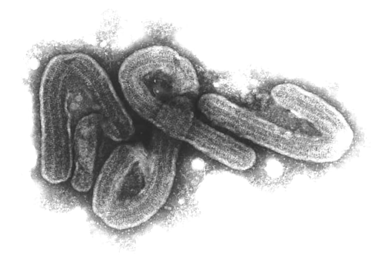 Marburg-Virus: Der Erreger gehört zu den gefährlichsten bekannten Krankheitsviren. Er trat 1967 zum ersten Mal in der Universitätsstadt auf.