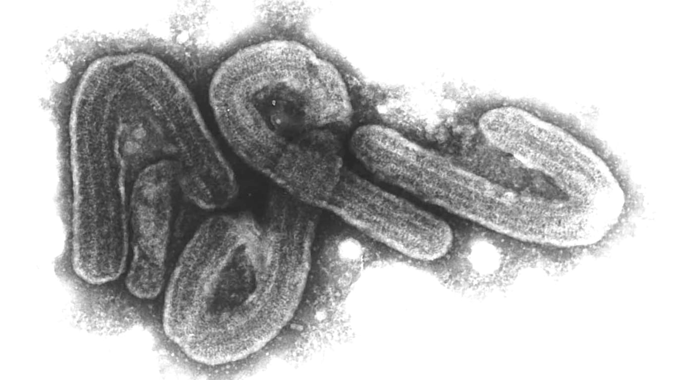 Marburg-Virus: Der Erreger gehört zu den gefährlichsten bekannten Krankheitsviren. Er trat 1967 zum ersten Mal in der Universitätsstadt auf.