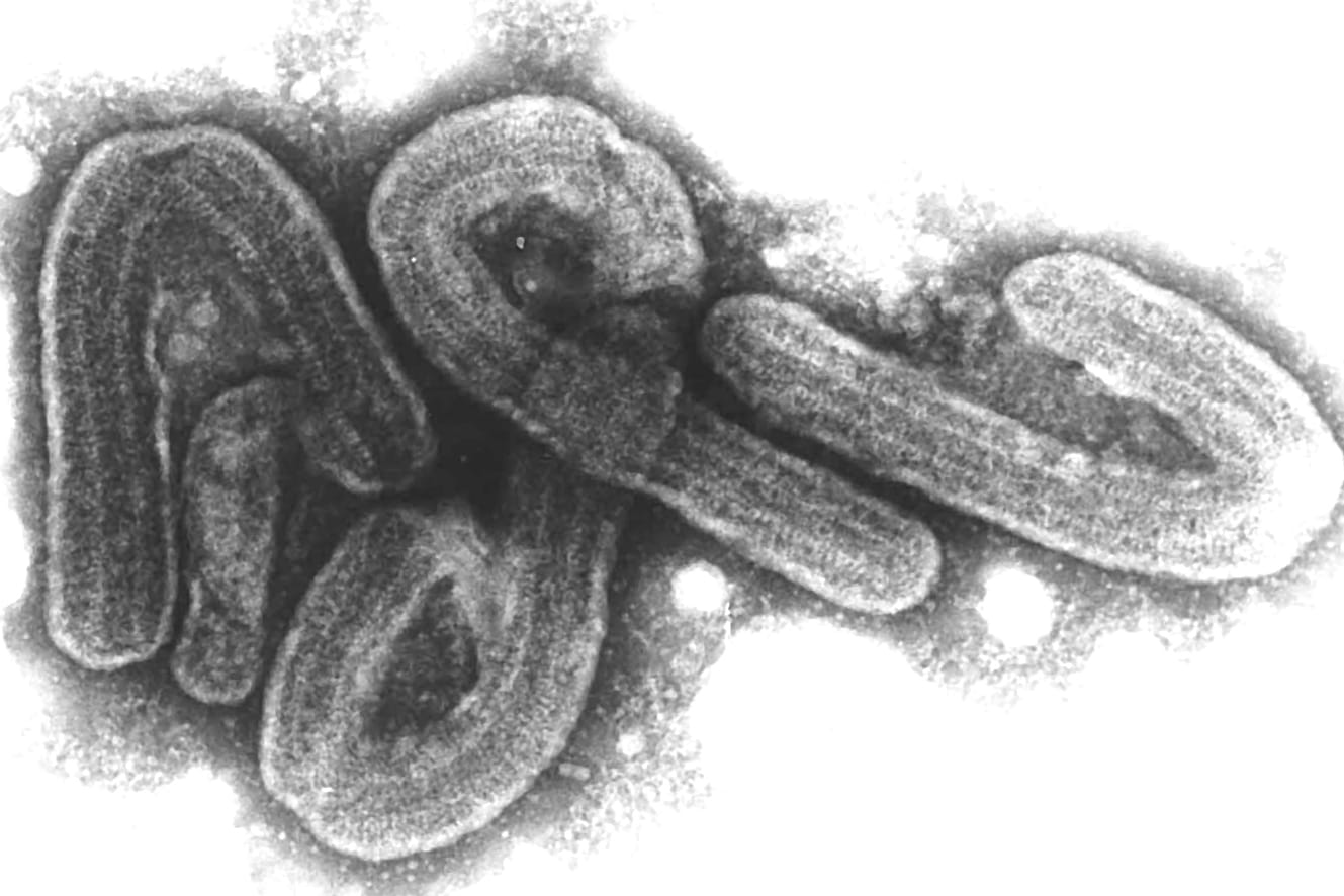 Marburg-Virus: Der Erreger gehört zu den gefährlichsten bekannten Krankheitsviren. Er trat 1967 zum ersten Mal in der Universitätsstadt auf.