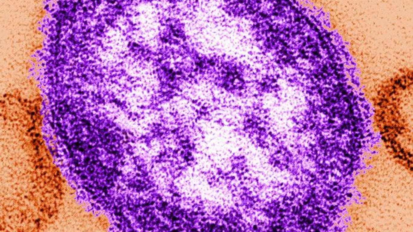 Das Bild zeigt Teile des Masernvirus mit Hilfe eines Transmissionselektronenmikroskops. Zahl der Masern-Infektionen steigt.