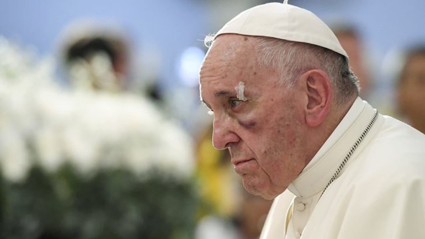 Voller Einsatz: Papst Franziskus verletzte sich, als er in Kolumbien ein Kind grüßen wollte.
