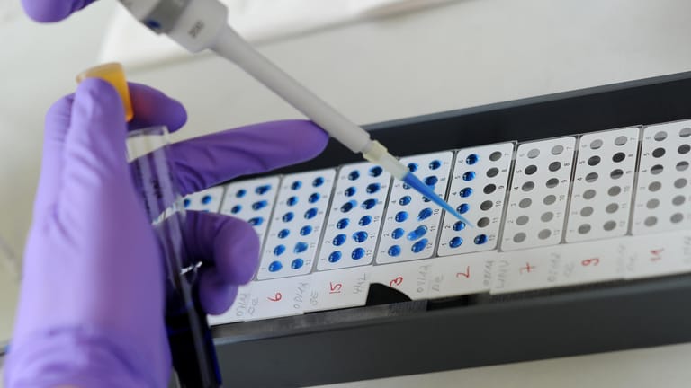 Ein Medizinisch Technischer Assistent detektiert im Bernhard-Nocht-Institut für Tropenmedizin (BNI) eine bereits abgeschlossene Antigen-Antikörper-Reaktion.