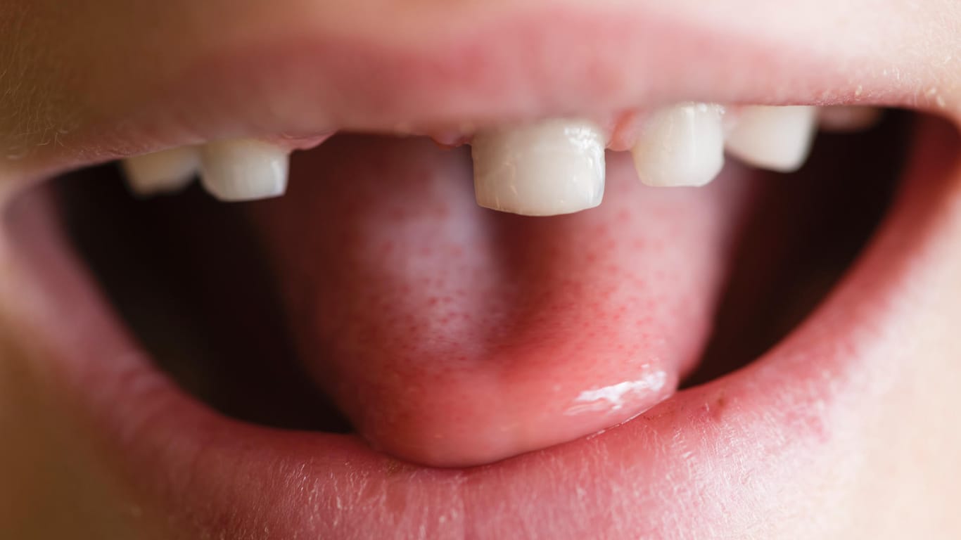 Kindermund mit Zahnlücke