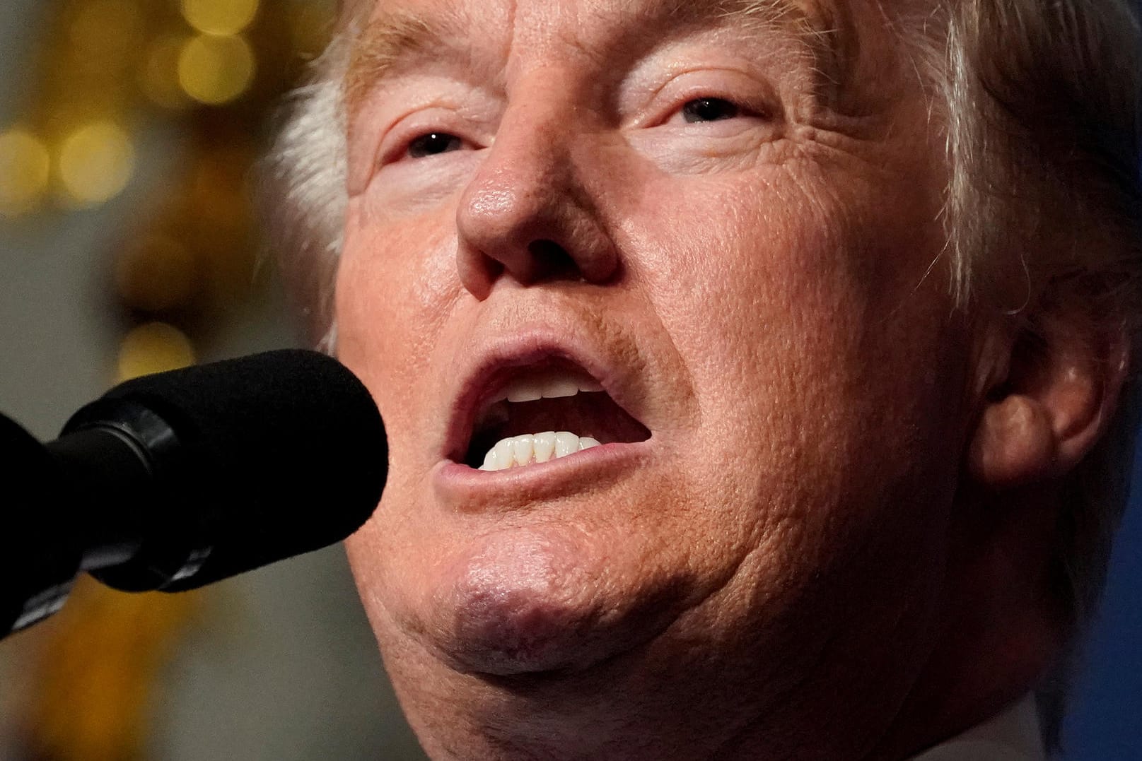 US-Fachärzte attestieren Donald Trump eine gefährliche psychische Erkrankung.