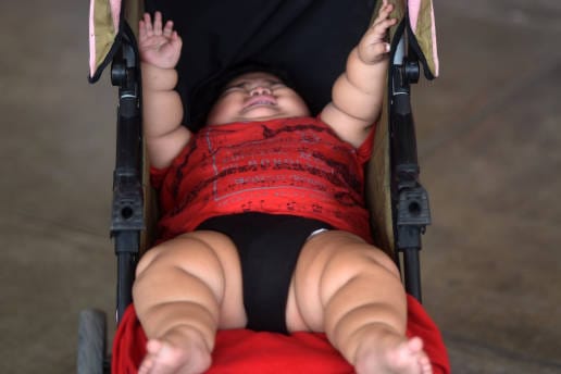 Baby in Mexiko bringt 28 Kilo auf die Waage