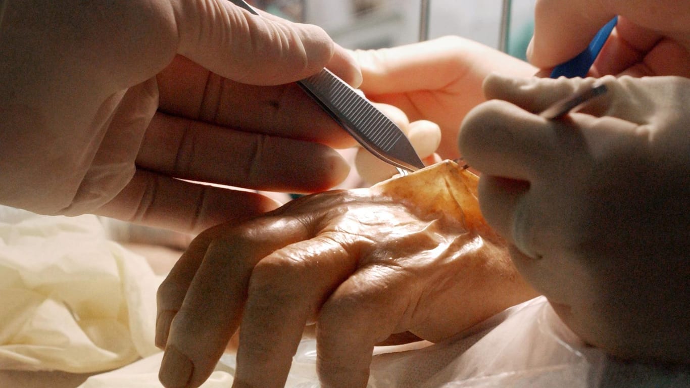 Handchirurgen der plastischen Chirurgie trainieren an einer Leichenhand.