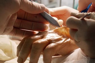 Handchirurgen der plastischen Chirurgie trainieren an einer Leichenhand.
