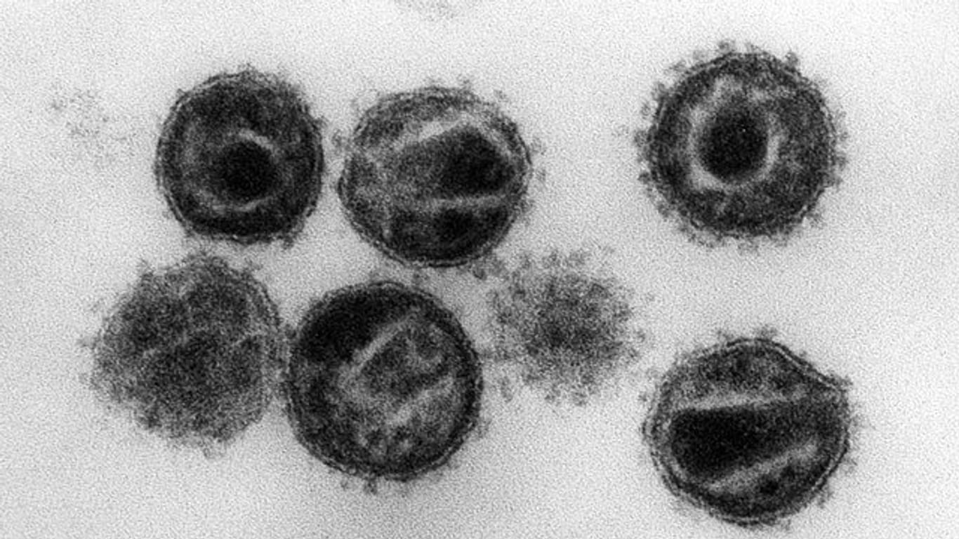 HI-Viren unter einem Elektronenmikroskop: Die Zahl der Neuinfektionen bleibt in Deutschland konstant.