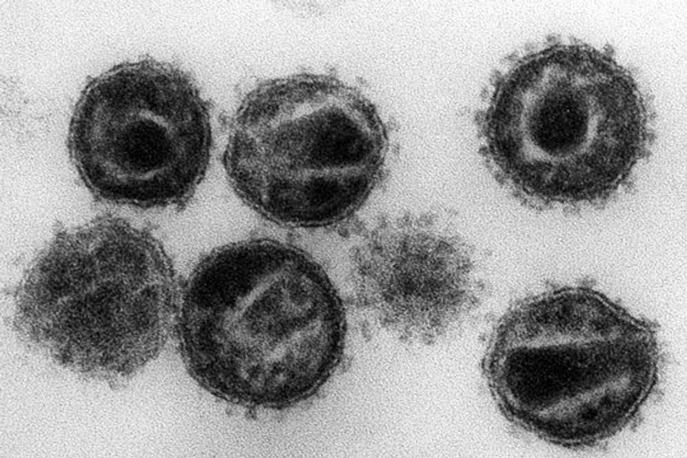 HI-Viren unter einem Elektronenmikroskop: Die Zahl der Neuinfektionen bleibt in Deutschland konstant.