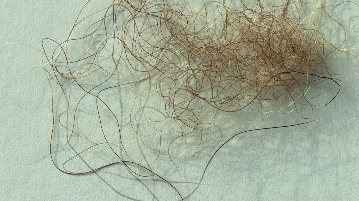 Das Foto zeigt eine Haarprobe eines angeblichen Yetis.