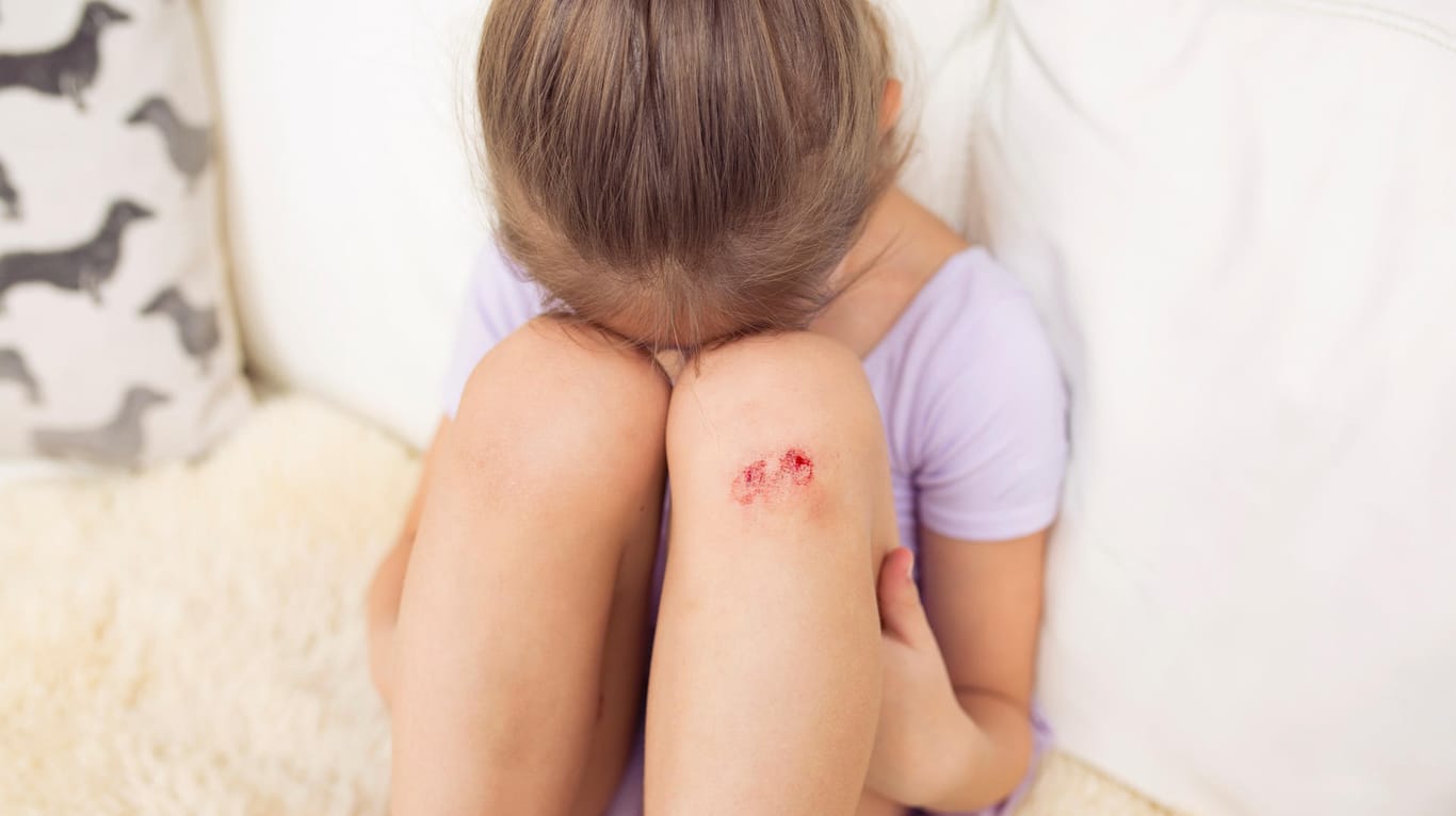 Hat sich das Kind beim Spielen verletzt, sollten Eltern auf bestimmte Warnsymptome achten.