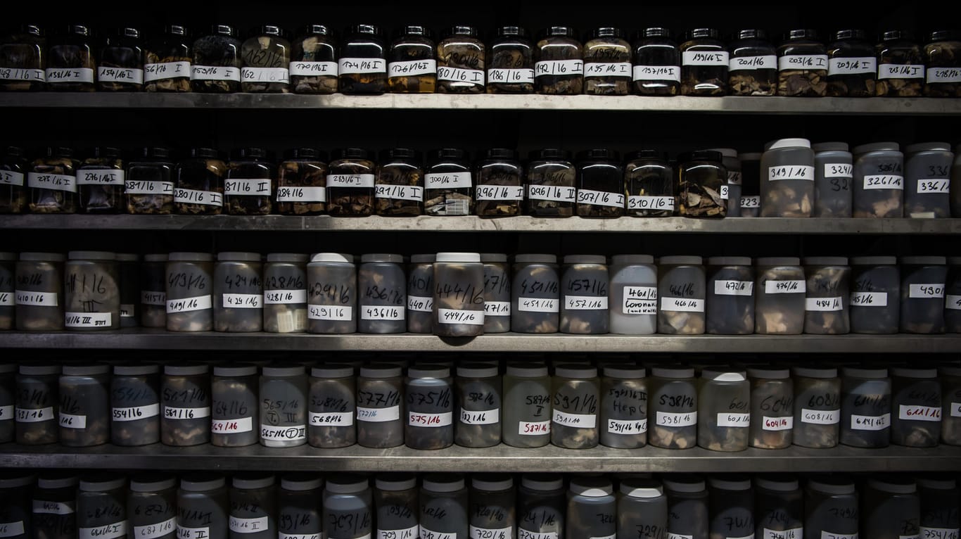 Transparentes Archiv: Im Frankfurter Institut für Rechtsmedizin wird Gewebe von Leichen in Glas- und Plastikbehältern aufbewahrt.