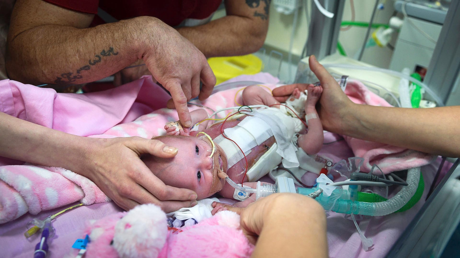 Die kleine Vanellope Hope Wilkins im Krankenhaus.