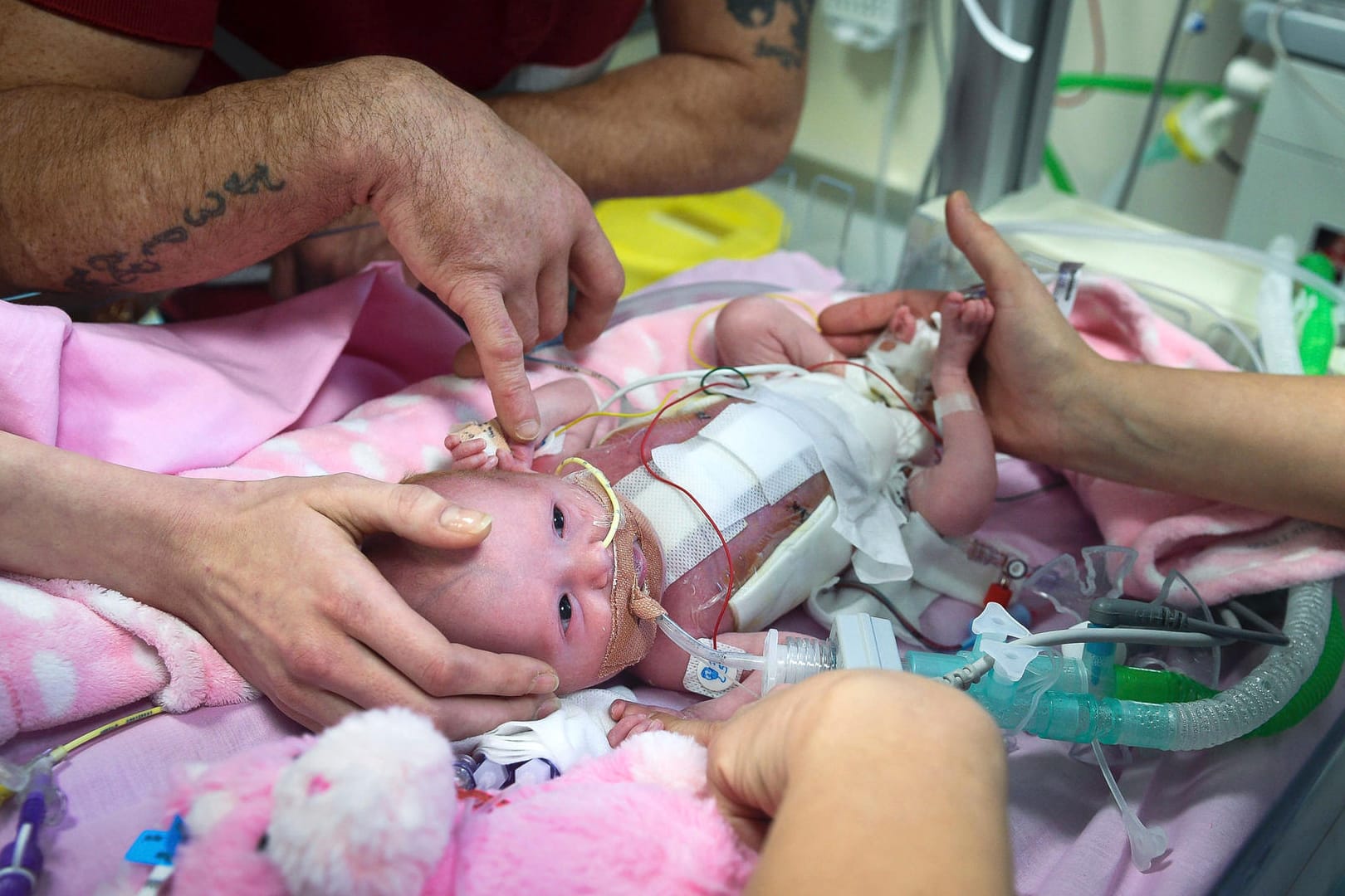 Die kleine Vanellope Hope Wilkins im Krankenhaus.