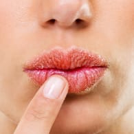 Lippenpflege im Winter: Minusgrade und trockene Heizungsluft bedeuten Stress für die Haut. Sie bedarf jetzt einer speziellen Pflege