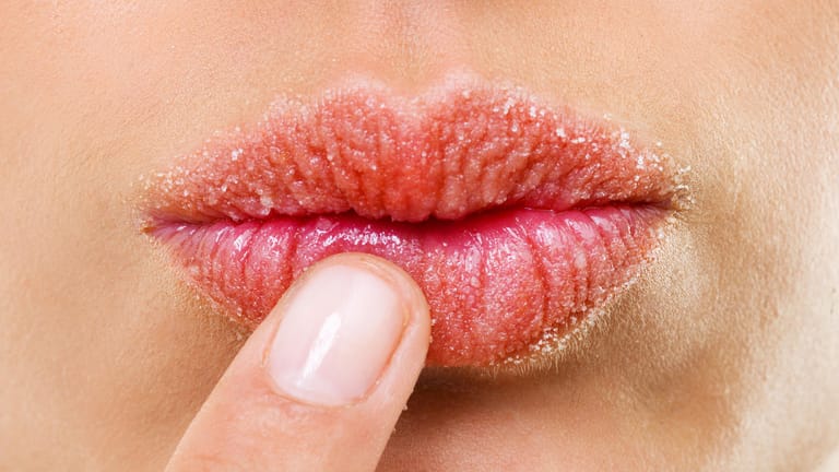 Lippenpflege im Winter: Minusgrade und trockene Heizungsluft bedeuten Stress für die Haut. Sie bedarf jetzt einer speziellen Pflege