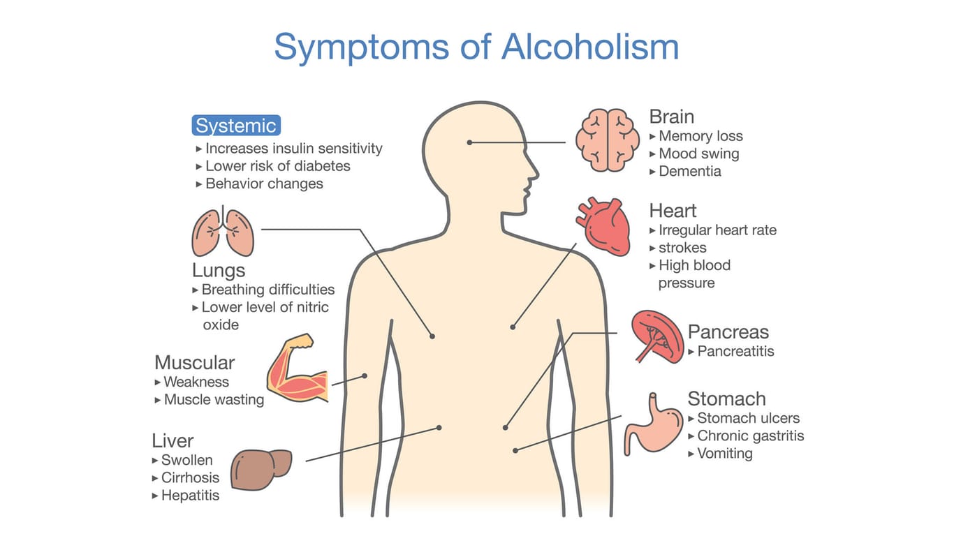 Anatomische Grafik – welche Schäden Alkohol im Körper verursacht