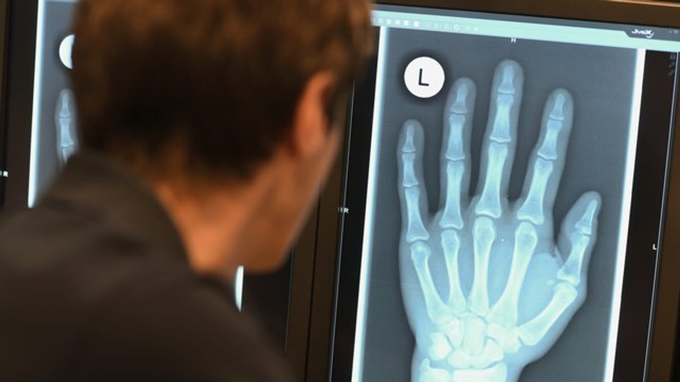 Ein Radiologe schaut sich im Röntgenbild die linke Hand eines 17-Jährigen an.