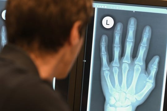Ein Radiologe schaut sich im Röntgenbild die linke Hand eines 17-Jährigen an.