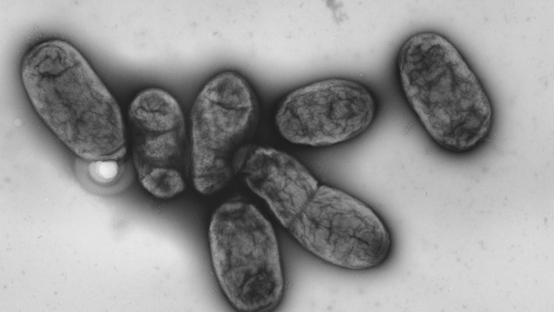 Yersinia pestis: Der Erreger der Pest wütete wahrscheinlich viel früher in Europa als bislang angenommen.