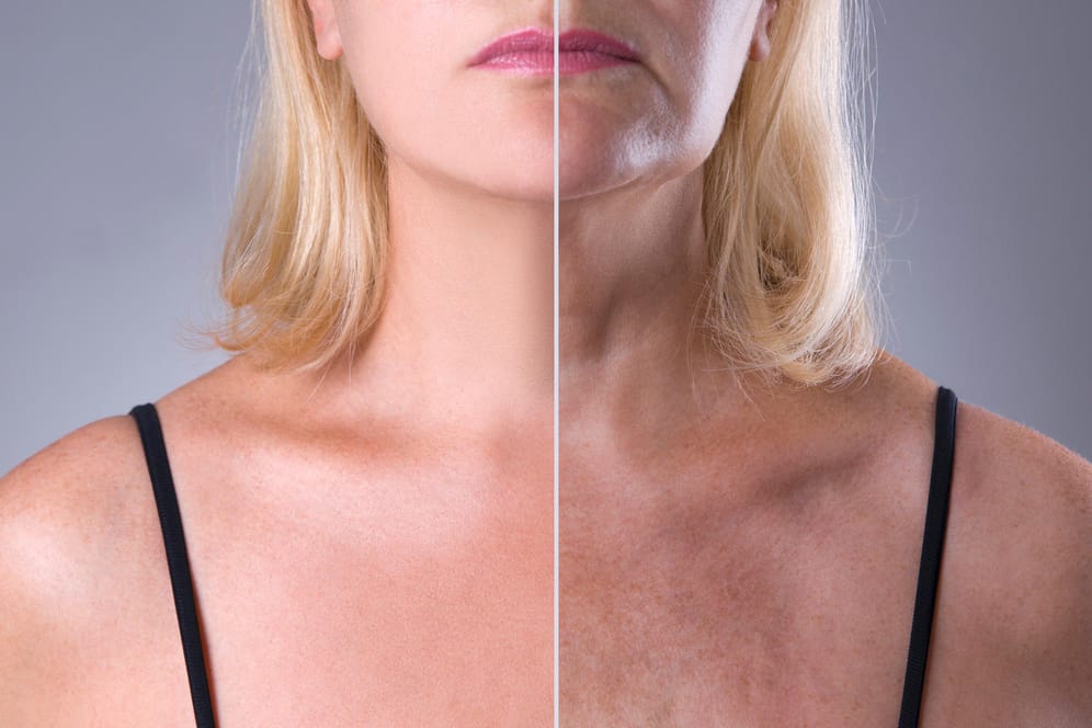 Altern: Ein wesentlicher Treiber für das sichtbare Altern sind neben äußerlichen Einwirkungen auf die Haut Stoffe, die wir durch den Mund zu uns nehmen.