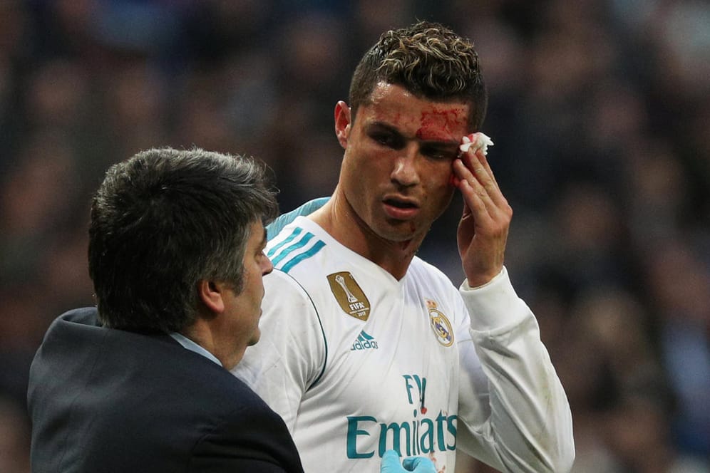 Nach dem Treffer zum 6:1: Ronaldo wird mit einer blutenden Kopfwunde vom Platz gebracht.
