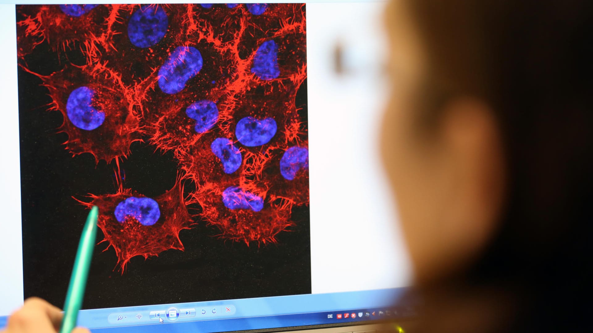 Tumor-Forschung: Können die weltweit verbreiteten Klonkrebse helfen?
