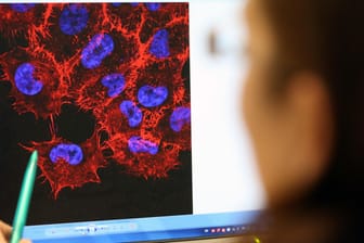 Tumor-Forschung: Können die weltweit verbreiteten Klonkrebse helfen?