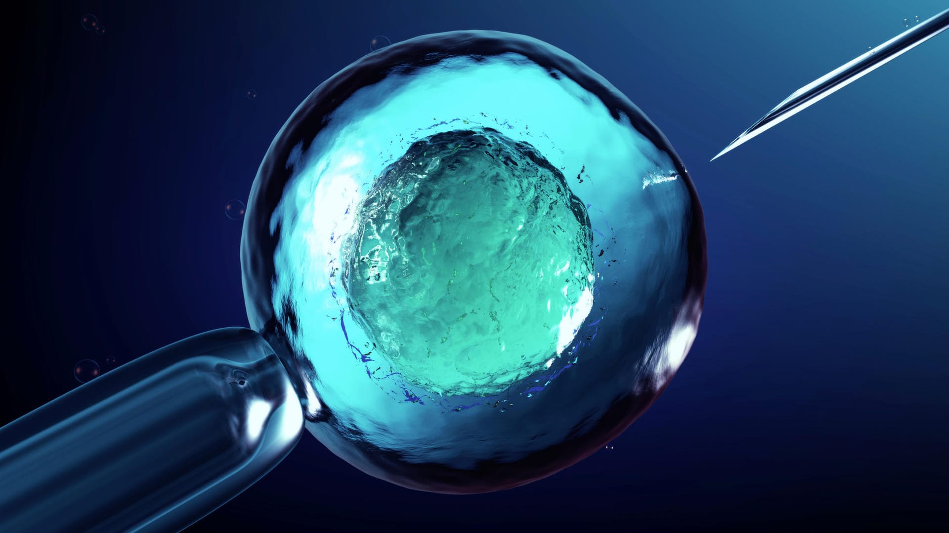 in-vitro-Befruchtung in-vitro-Befruchtung