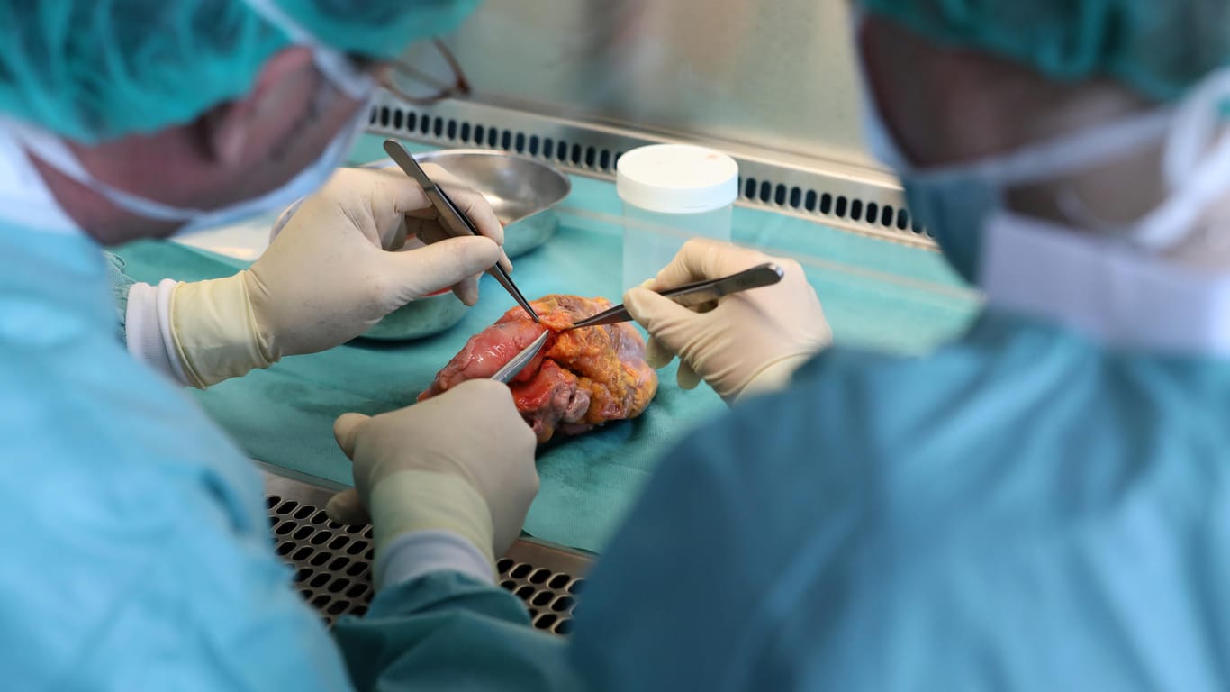 Mediziner mit einem menschlichen Herz: In den Niederlanden gilt nun jeder Volljährige als potenzieller Organspender.
