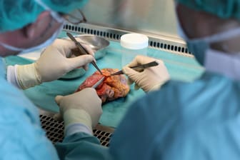 Mediziner mit einem menschlichen Herz: In den Niederlanden gilt nun jeder Volljährige als potenzieller Organspender.