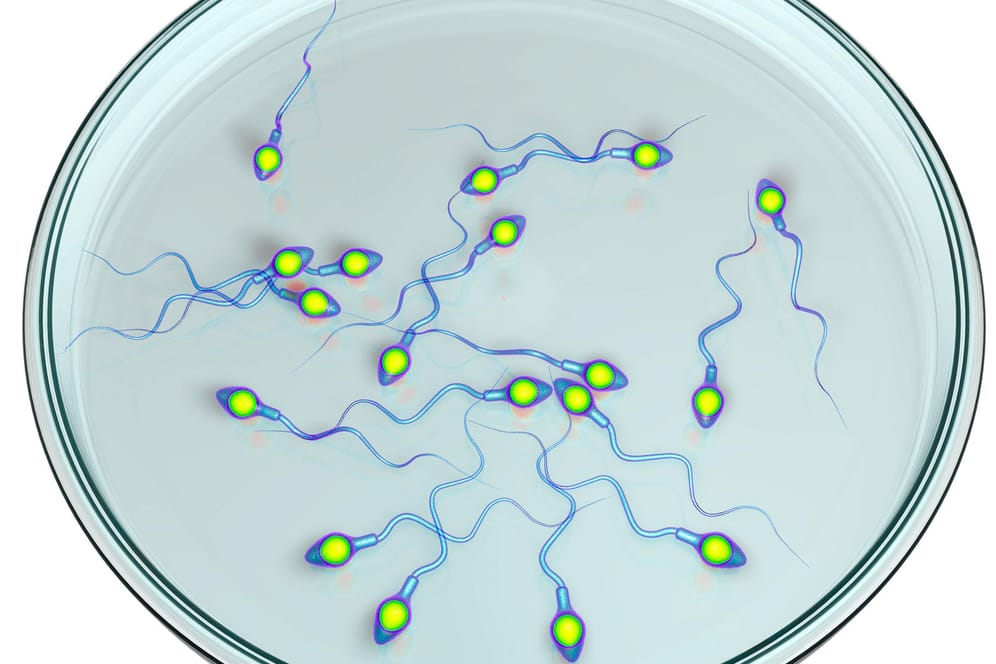 Spermien in einer Petrischale