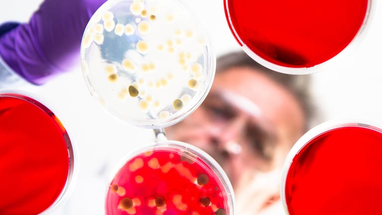 Ein Wissenschaftler untersucht eine Bakterienkultur in einer Petrischale.